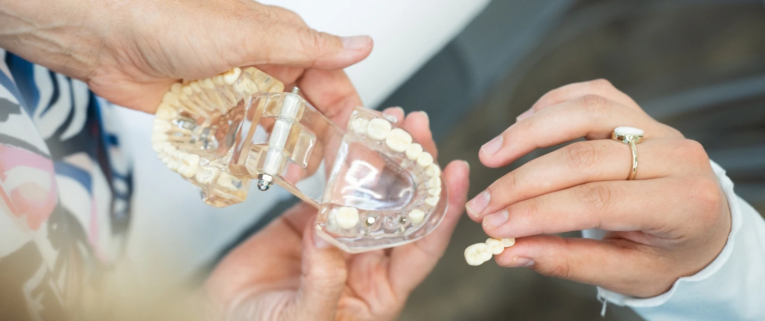 Hände von Patienten begutachten Zahnersatz/Implantat-Optionen bei DEIN DENTAL Lindau